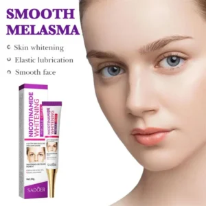 Nicotinamide Whitening Freckles Cream Remove Melasma Dark Spot Acne Marks Lightening Melanin Brightens Skin Tone Face Skin Care - Image 5