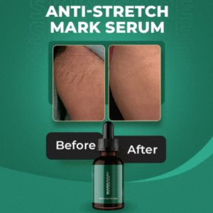 Markaway Stretch Mark Serum ? Herbal Formula for Hydration, Toning & Dark Spot Correction (30ml) - Image 3