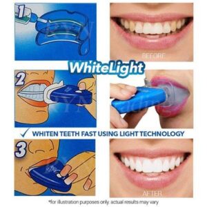 White Light Teeth Brightener - Image 1