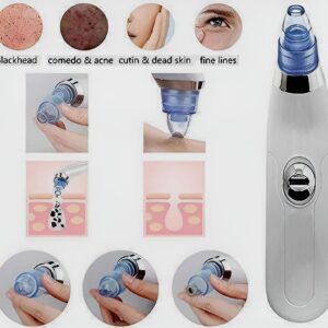 Derma Suction Blackhead Remover Vacuum Suck The Yuck Out Of Your Pores (cell Operated ) - Image 1