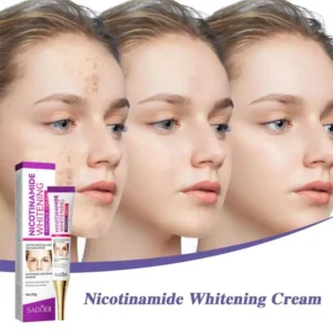 Nicotinamide Whitening Freckles Cream Remove Melasma Dark Spot Acne Marks Lightening Melanin Brightens Skin Tone Face Skin Care - Image 4