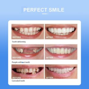Snap-On smile for Beautiful Smiles Temporary Comfort Fit Whitening Instant Transformation for Men & Women - Image 3