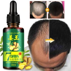 7 Day Ginger Germinal Oil Hair Nutrient Solution Hair Growth Essence Liquid Fast Natural Hair Loss Treatment Hair Care (30ml) - Image 3