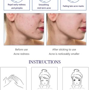 Aichun Beauty Anti - Acne Whitening Facial Serum Aloe Vera Extract Salicylic Acid Repairs Damaged Skin | 30ml - Image 5