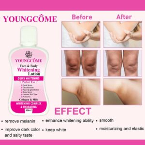 YOUNGCOME 60ml Face Body Whitening Lotion Underarm Brightening Private Underarm Body Cream Legs Whitening Parts - Image 1