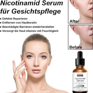 Pretty Cowry Nicotinamide Serum with Vitamin C | 30 ml Nicotinamide Face Serum for Anti-Wrinkles and Age, Even Skin, Against Blemishes and Stains - Image 3