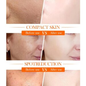 Sadoer 5x Vitamin C Skin Active whitening Cream | Vitamin C Hydrating Face Cream - Glowing & Repairing Moisturizer for Fine Lines, Wrinkles & Uneven Skin Tone | Whitening Cream - Image 1