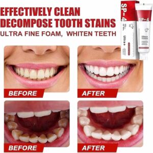 Yayashi Sp-4 Ultra Whitening Toothpaste Probiotic Stain Remover 100ml / Stain Removing Toothpaste, Protects Gums Freshens Breath, for Everyone - Image 4
