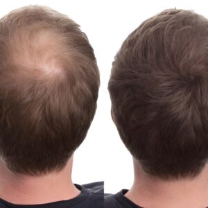 CABOKI HAIR BUILDING FIBERS - 25g - Image 1