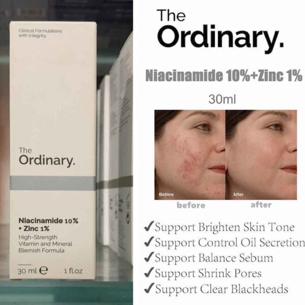 THE-ORDINARY-Niacinamide-Serum.jpeg