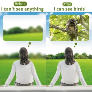 Quickly Restore Vision Myopia Treatment Lutein Eye Patch Improve Eye Edema Relieve Fatigue Help Sleeping Focus On Eye Health - Image 3