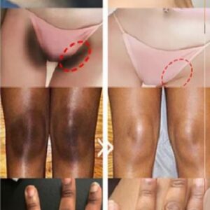 Whitening Cream for sensitive Areas underarm and private Areas - 30g - Image 2