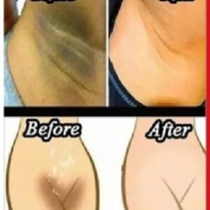 Whitening Cream for sensitive Areas underarm and private Areas - 30g - Image 3