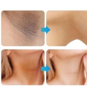 Whitening Cream for sensitive Areas underarm and private Areas - 30g - Image 1