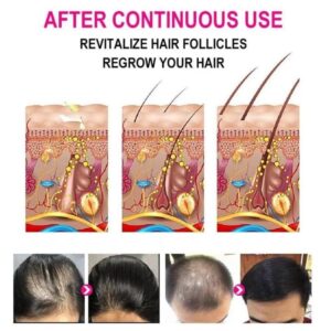 Anti-Grey Hair Serum, 30Ml - Image 1