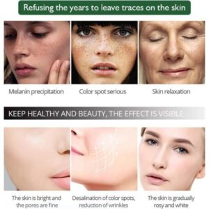 100% original Aichun Anti Freckle Whitening Facial Serum 30ml - Image 5