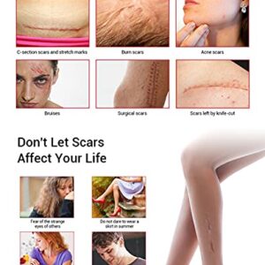 AICHUN BEAUTY Scar Removal Facial Serum Pimples Stretch Marks Face Moisturizing Body Remove Scars Kojic Acid Vitamin E 30ml - Image 4