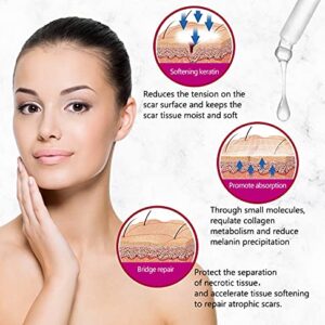 AICHUN BEAUTY Scar Removal Facial Serum Pimples Stretch Marks Face Moisturizing Body Remove Scars Kojic Acid Vitamin E 30ml - Image 1