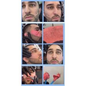 Hair Removing Hard Beans Wax Painless Beauty Wax Beans for All Skins Wax Beans for Face Body Legs - 1 Pc (random color) - Image 4