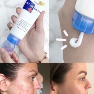 Mistine Acne Clear Face Wash Facial Foam 85 ml - Image 3