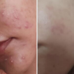 Nirvana Botanics- Vitamin C + E Serum 15ml | Best Quality Serum - Image 2