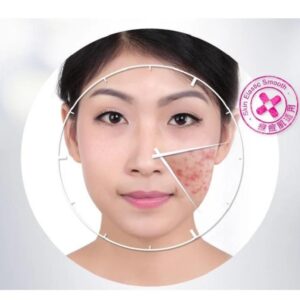 BIOAQUA Anti Acne Cream Acne Scar Removal Cream | Best Quality Scar Removal Cream 30g( Original ) - Image 4