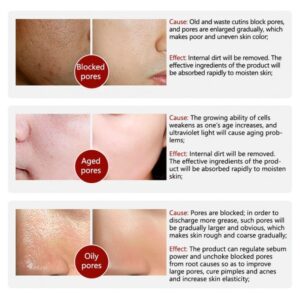 Rorec Moisturizing Anti Wrinkle Rice Face Serum for Open Pores 15ml - Image 4