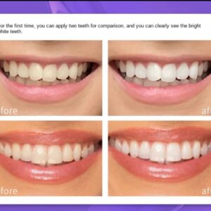 Teeth Brightening Hismiles V34 Colour Corrector Serum 30ml - Image 5