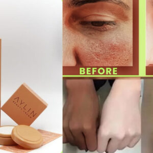 Aylin Beauty Cream Best Cream Ever | Best Quality Cream |? Aylin Beauty Cream For Face Acne Pimples, & Blackheads | Whitening Cream ( Original ) - Image 5