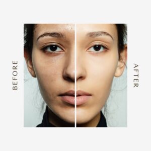 Pack of 3 The Ordinary Glycolic Acid (240ML) + The Ordinary Skin Brightening Niacinamide 10% Zinc 1%?Serum (20ml) + Glow natural Glutathione Alpha Arbutin Skin Brightening Cream (50g) - Image 5