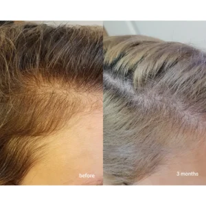 The Ordinary Multi-Peptide Serum for Hair Density (Product with bar code & batch code) - Image 5